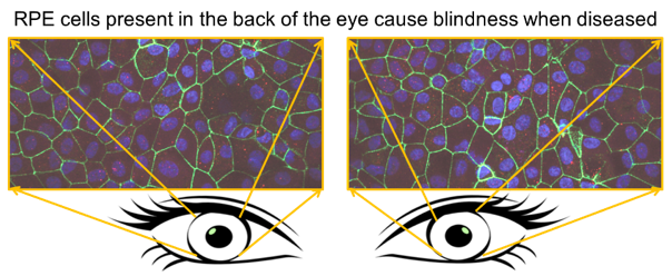 RPE cell diagram